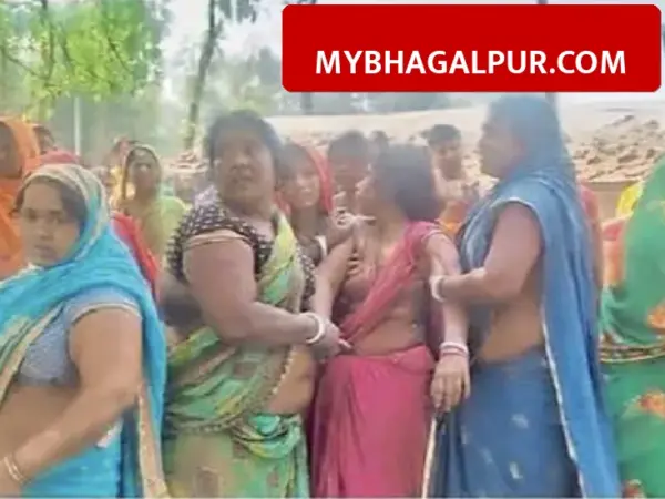 भागलपुर के बिहपुर में अमरूद के पेड़ से लटका मिला युवक का शव, मां ने कहा- मारकर टांग दिया